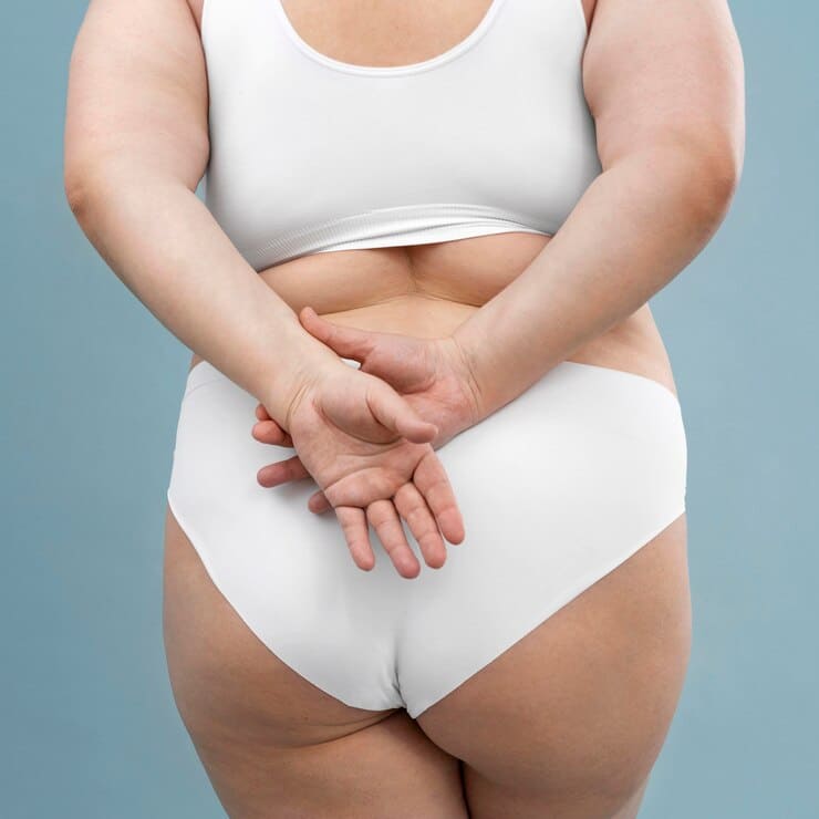 Celulitis